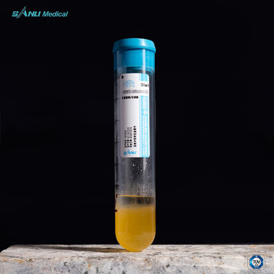 OA Tedavisi için JEL ile Ağrı PRP Test Tüpü 20ml ACD-A Rahatlatmak